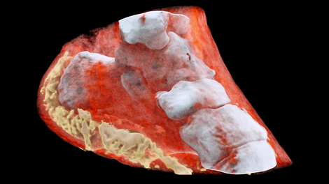 Illustration for article titled The World's First Full-Color, 3D X-rays Are Freaking Me Out